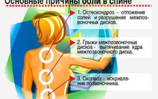 Йога против боли в спине