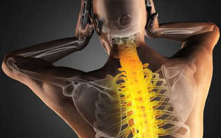 Упражнения для исправления спины