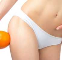 Упражнения от целлюлита на ногах видео